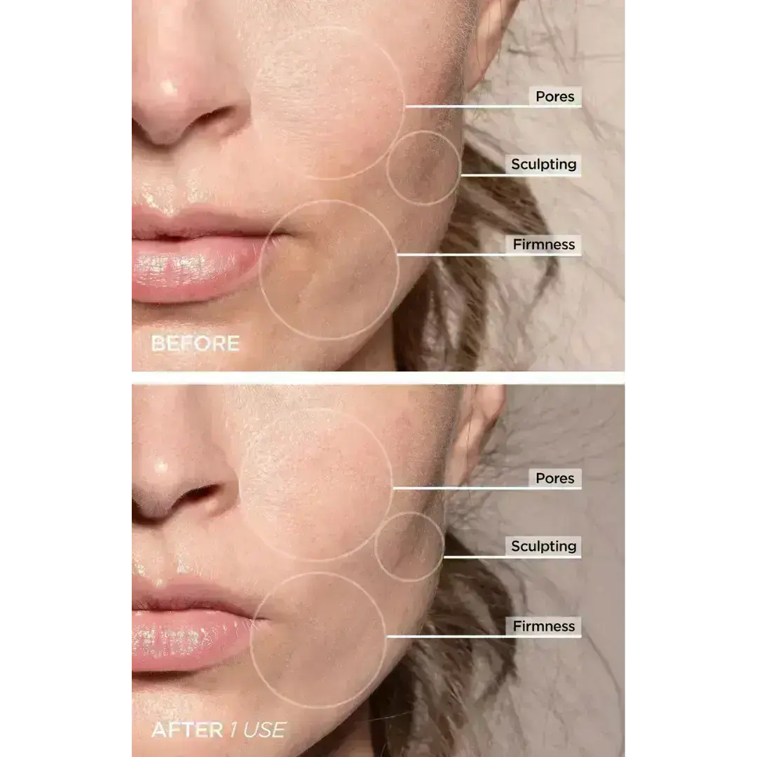 GlowPro LED Skin Sculptor