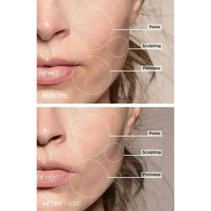 GlowPro LED Skin Sculptor