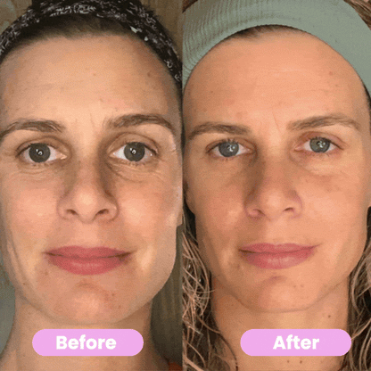 GlowPro LED Skin Sculptor
